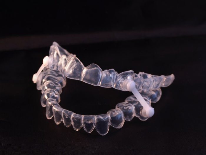 How to Adjust to Your New Oral Appliance : Florida Dental Sleep Disorders